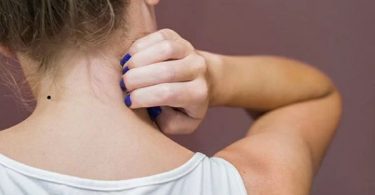 Nốt ruồi sau gáy là gì